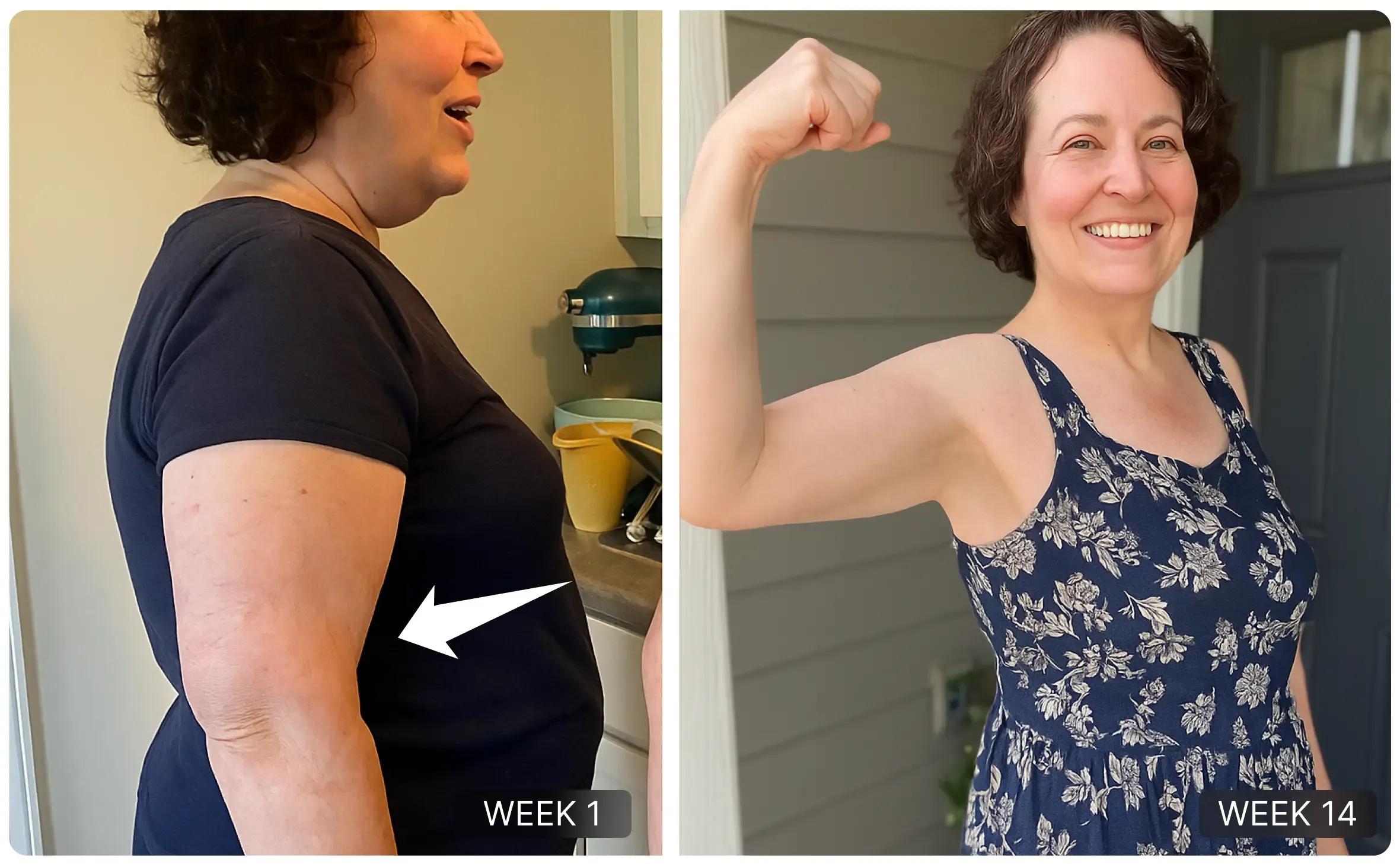 Before and after arm skin transformation